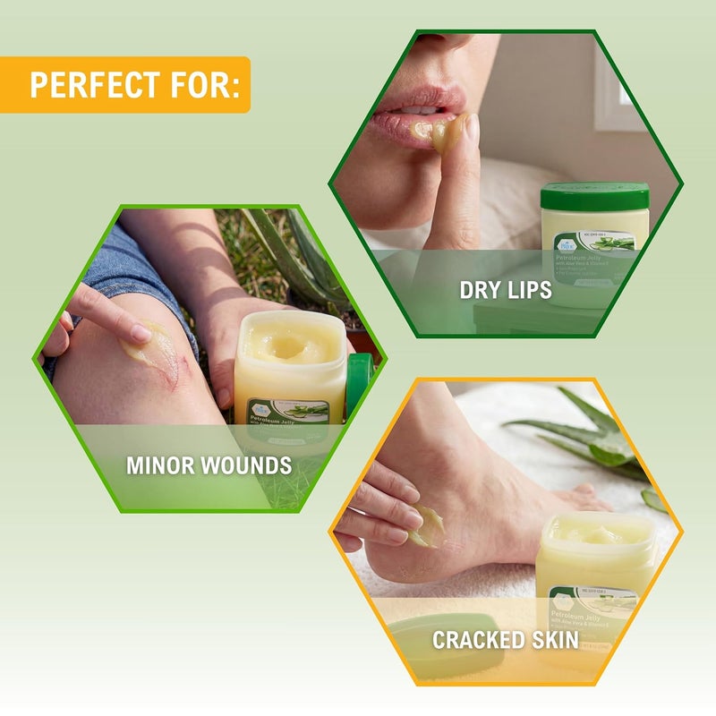 Medpride Petroleum Jelly with Aloe Vera & Vitamin E, 8 oz – Skin Protectant and Moisturizing Ointment for Dry or Irritated Skin, Rashes, Chapped Lips, Minor Cuts, Burns and Diaper Rash - Image 4